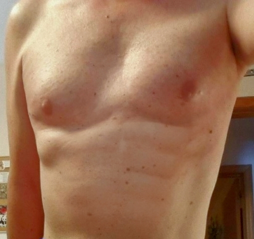 Chest, ***ly, Torso Pic