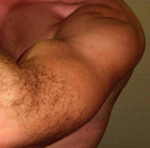 Robin0815 muscle