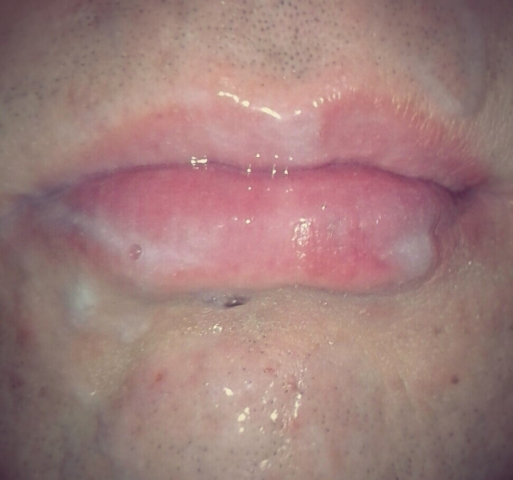 sperma
