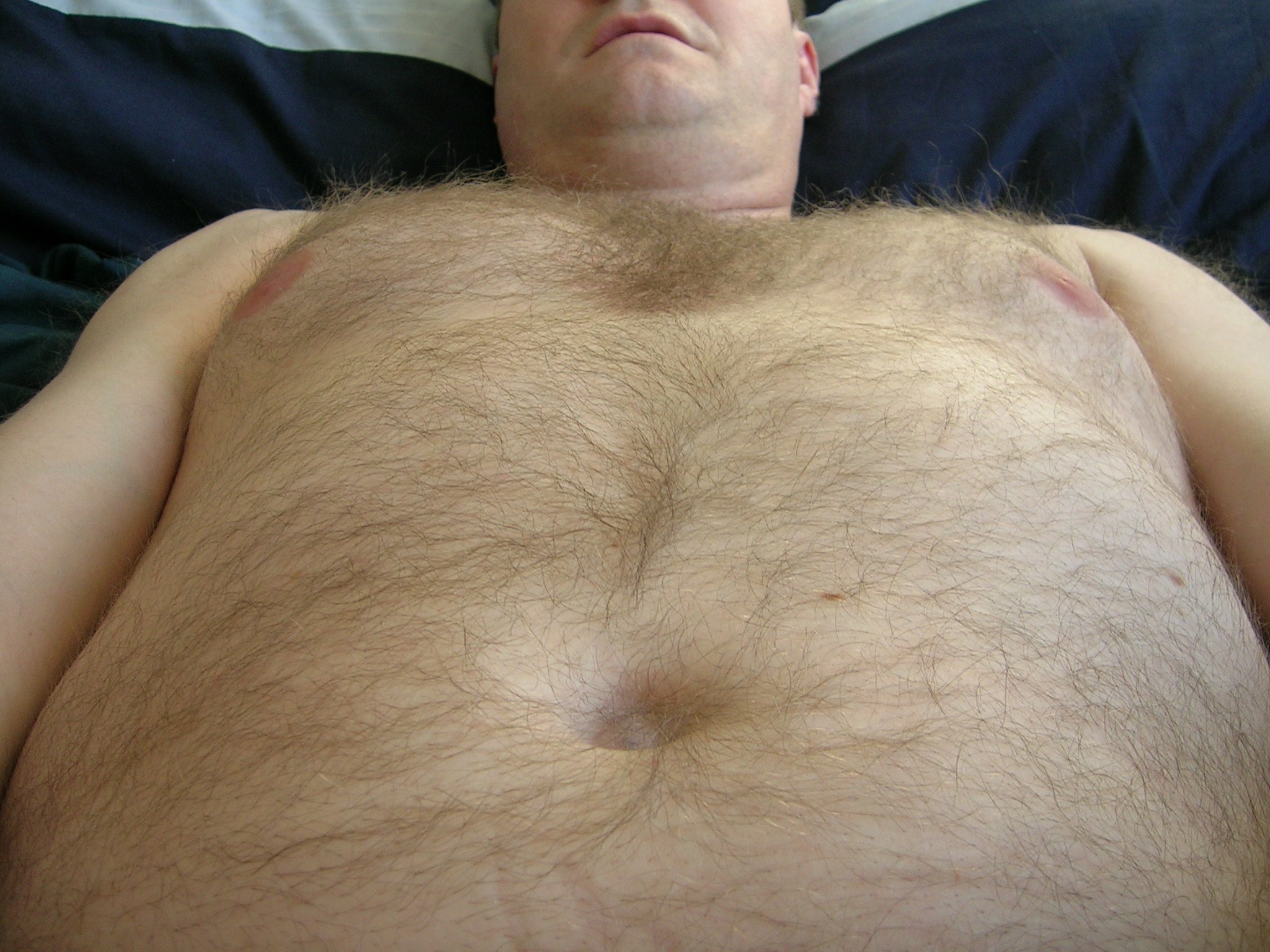 Hairy body