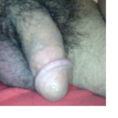 my penis