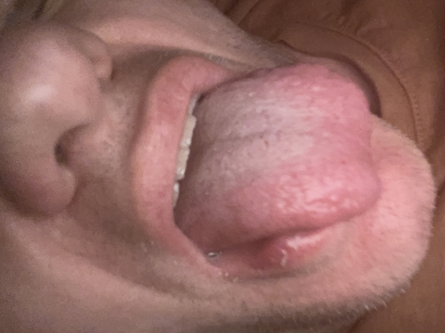 Tongue 