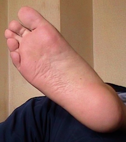 my sole