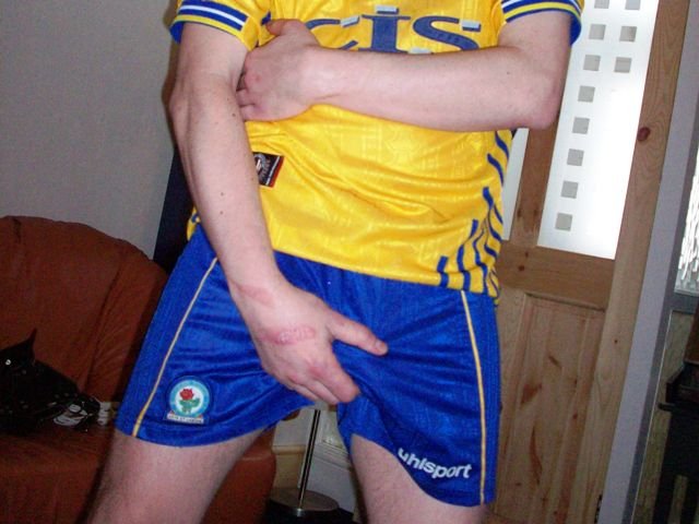 mattskinlad