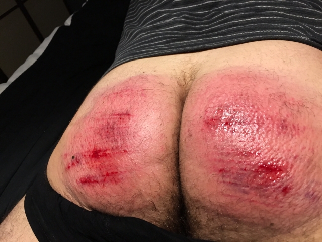 Severe Caning