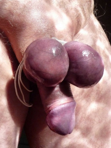 Bondage