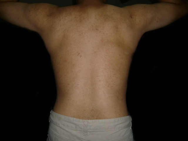 my back