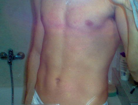 Chest