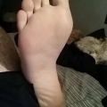 CP